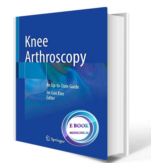 دانلود کتابKnee Arthroscopy: An Up-to-Date Guide 1st ed. 2021(ORIGINAL PDF)